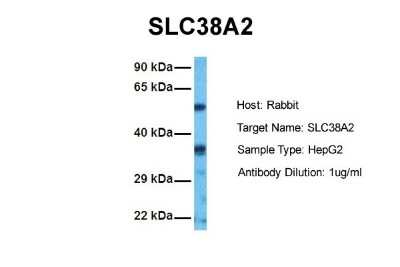 Western Blot: SLC38A2 Antibody [NBP2-83554]