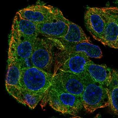 Immunocytochemistry/ Immunofluorescence: SLC38A3 Antibody [NBP2-58073]