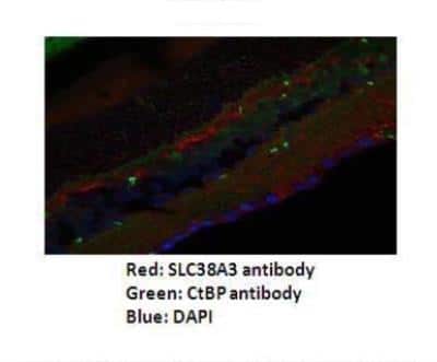 Immunohistochemistry: SLC38A3 Antibody [NBP1-60103]
