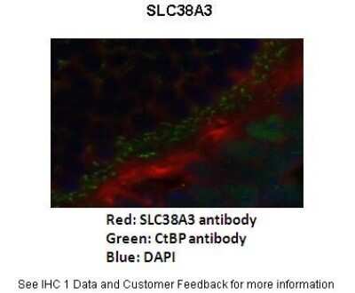 Immunohistochemistry: SLC38A3 Antibody [NBP1-60103]