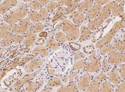 Immunohistochemistry-Paraffin: SLC38A3 Antibody [NBP3-06519]