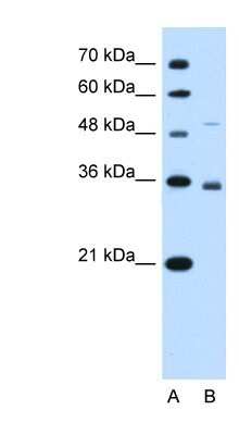 Western Blot: SLC38A3 Antibody [NBP1-60103]
