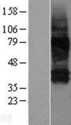 Western Blot: SLC38A3 Overexpression Lysate [NBP2-07572]