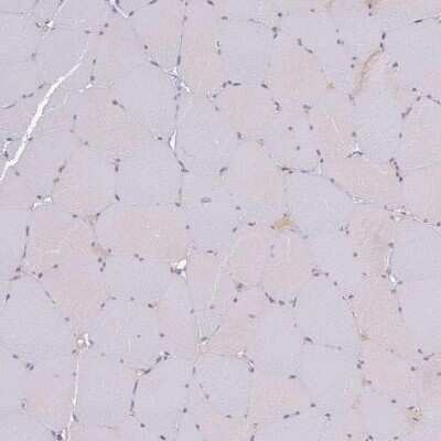Immunohistochemistry-Paraffin: SLC38A9 Antibody [NBP1-92403]
