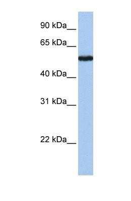 Western Blot: SLC38A9 Antibody [NBP1-69235]