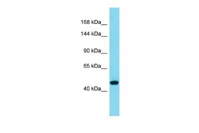 Western Blot: SLC39A10 Antibody [NBP3-10959]