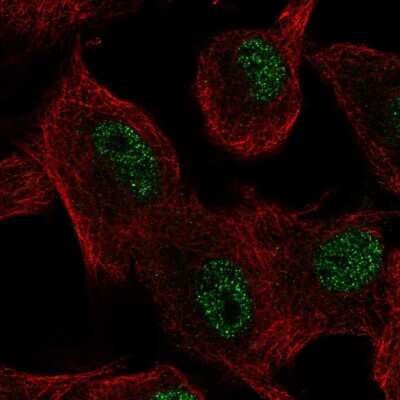 Immunocytochemistry/ Immunofluorescence: SLC39A11 Antibody [NBP2-58224]