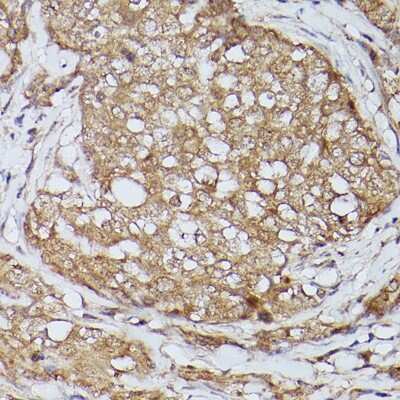 Immunohistochemistry-Paraffin: SLC39A11 Antibody - Azide and BSA Free [NBP3-16004]