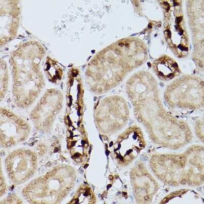Immunohistochemistry-Paraffin: SLC39A11 Antibody - Azide and BSA Free [NBP3-16004]