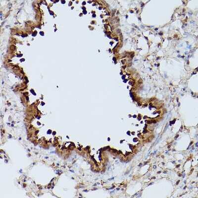 Immunohistochemistry-Paraffin: SLC39A11 Antibody - Azide and BSA Free [NBP3-16004]