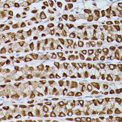 Immunohistochemistry-Paraffin: SLC39A11 Antibody - Azide and BSA Free [NBP3-16004]