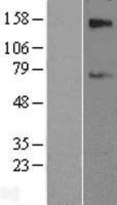 Western Blot: SLC39A12 Overexpression Lysate [NBL1-16142]