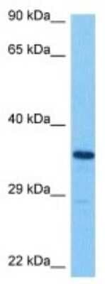 Western Blot: SLC39A13 Antibody [NBP3-10021]