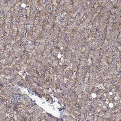 Immunohistochemistry-Paraffin: SLC39A14 Antibody [NBP3-17091]