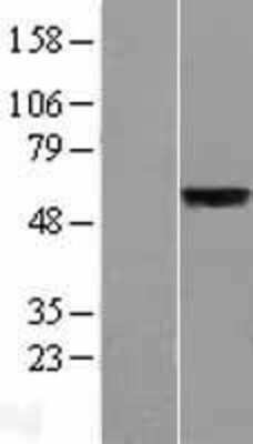Western Blot: SLC39A5 Overexpression Lysate [NBL1-16149]