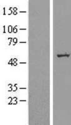Western Blot: SLC39A7/ZIP7 Overexpression Lysate [NBP2-11451]