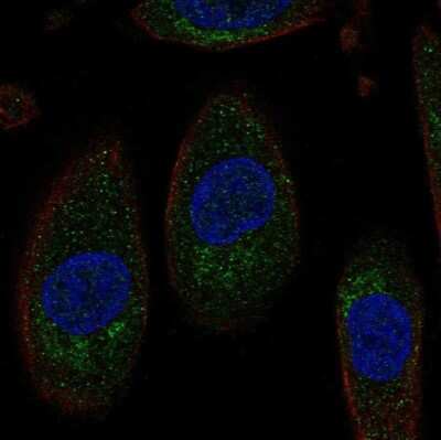Immunocytochemistry/ Immunofluorescence: SLC3A1 Antibody [NBP2-68912]