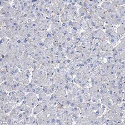 Immunohistochemistry-Paraffin: SLC43A2 Antibody [NBP1-82706]
