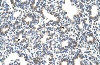Immunohistochemistry: SLC43A3 Antibody [NBP1-69535]