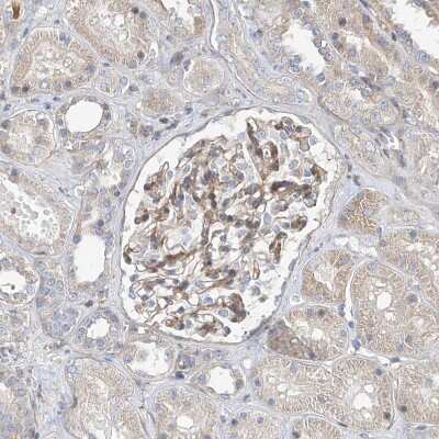 Immunohistochemistry-Paraffin: SLC43A3 Antibody [NBP1-85026]