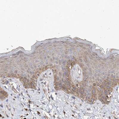 Immunohistochemistry-Paraffin: SLC43A3 Antibody [NBP1-85026]