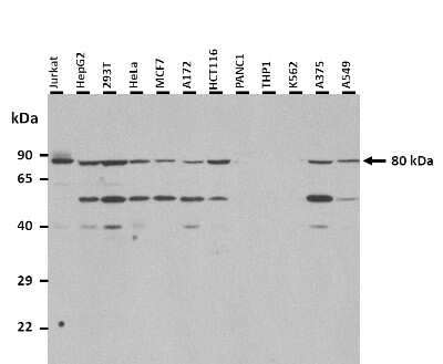 Western Blot: SLC44A2 Antibody [NBP3-10576]
