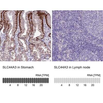 Immunohistochemistry-Paraffin: SLC44A3 Antibody [NBP2-13339]