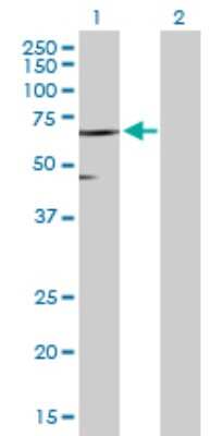 Western Blot: SLC45A2 Antibody [H00051151-D01P]