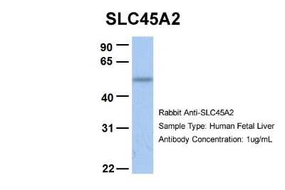 Western Blot: SLC45A2 Antibody [NBP1-59786]