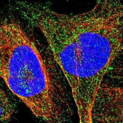 Immunocytochemistry/ Immunofluorescence: SLC45A3/Prostein Antibody [NBP1-89629]