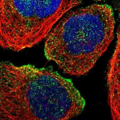 Immunocytochemistry/ Immunofluorescence: SLC45A3/Prostein Antibody [NBP1-89630]