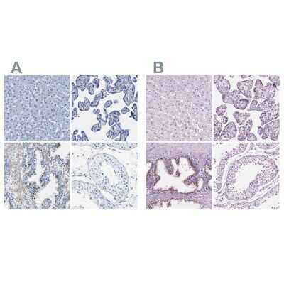 Immunohistochemistry-Paraffin: SLC45A3/Prostein Antibody [NBP1-89630]
