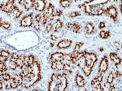 Immunohistochemistry-Paraffin: SLC45A3/Prostein Antibody (RM426) [NBP3-09178]