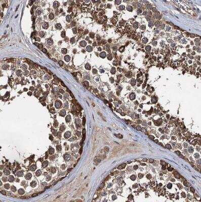 Immunohistochemistry-Paraffin: SLC46A3 Antibody [NBP1-85054]