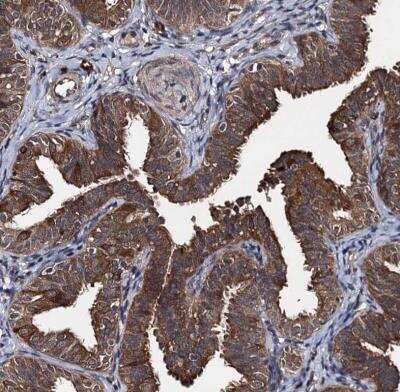 Immunohistochemistry-Paraffin: SLC46A3 Antibody [NBP1-85054]