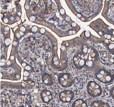 Immunohistochemistry-Paraffin: SLC46A3 Antibody [NBP1-85054]