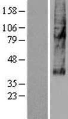 Western Blot: SLC46A3 Overexpression Lysate [NBP2-04889]