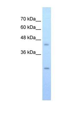 Western Blot: SLC48A1 Antibody [NBP1-91563]