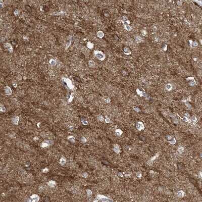 Immunohistochemistry-Paraffin: SLC4A10 Antibody [NBP1-82594]