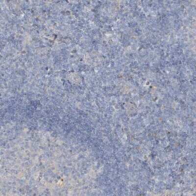 Immunohistochemistry-Paraffin: SLC4A10 Antibody [NBP1-82594]
