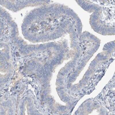 Immunohistochemistry-Paraffin: SLC4A10 Antibody [NBP1-82594]