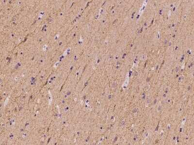 Immunohistochemistry-Paraffin: SLC4A10 Antibody [NBP2-98632]