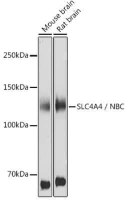 Western Blot: SLC4A4 AntibodyAzide and BSA Free [NBP2-94138]