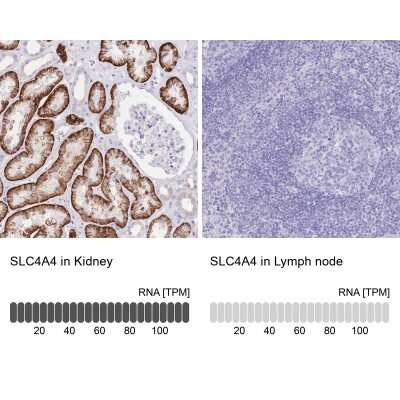Immunohistochemistry-Paraffin: SLC4A4 Antibody [NBP2-32020]