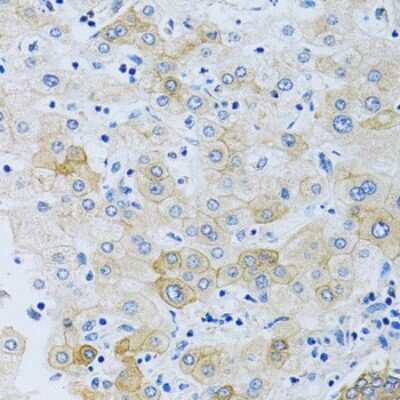 Immunohistochemistry-Paraffin: SLC4A5 Antibody - BSA Free [NBP2-93493]