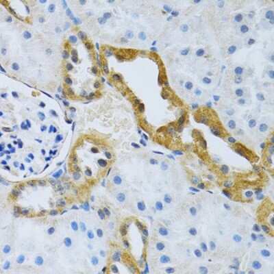 Immunohistochemistry-Paraffin: SLC4A5 Antibody - BSA Free [NBP2-93493]