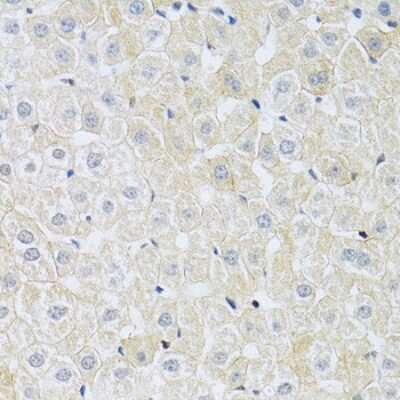 Immunohistochemistry-Paraffin: SLC4A5 Antibody - BSA Free [NBP2-93493]