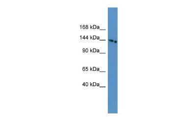 Western Blot: SLC4A5 Antibody [NBP2-84267]