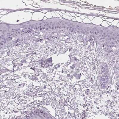 Immunohistochemistry-Paraffin: SLC5A12 Antibody [NBP2-49322]