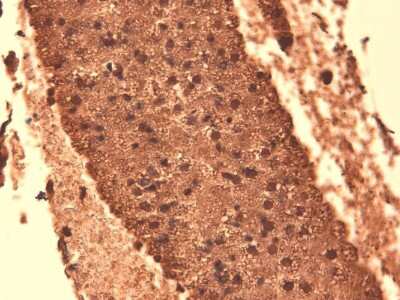 Immunohistochemistry: SLC5A5/Sodium Iodide Symporter Antibody (14F) [NBP2-59341]